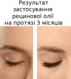 Результат застосування рицинової олії