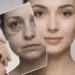 Cortisol face